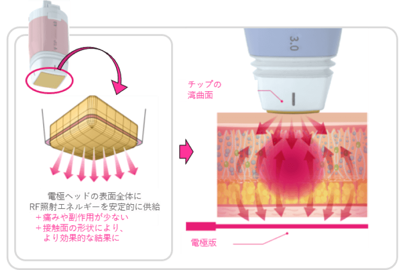 特徴02