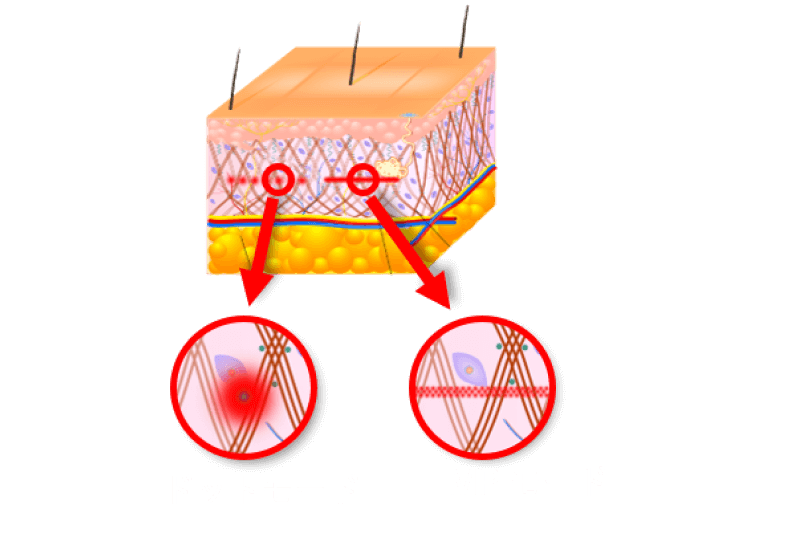 MPモード02