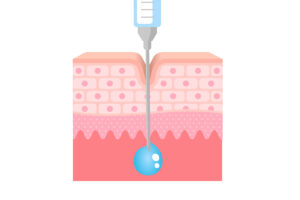 2-2. 手打ちの優位性：真皮のターゲット層を正確に狙う