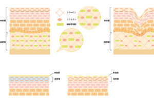 1-1. リジュランが肌細胞を活性化させる成分と仕組み