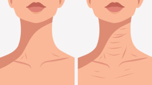 2-8. 首のしわ・デコルテの質感改善