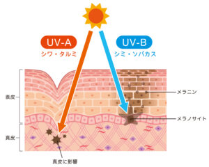 2-2. 乾燥と紫外線ダメージの蓄積