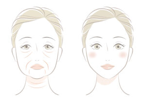 第2章. 目の下にクマやたるみができる3つの原因
