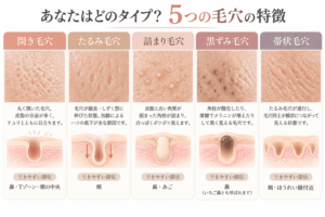 5つの毛穴タイプ図鑑